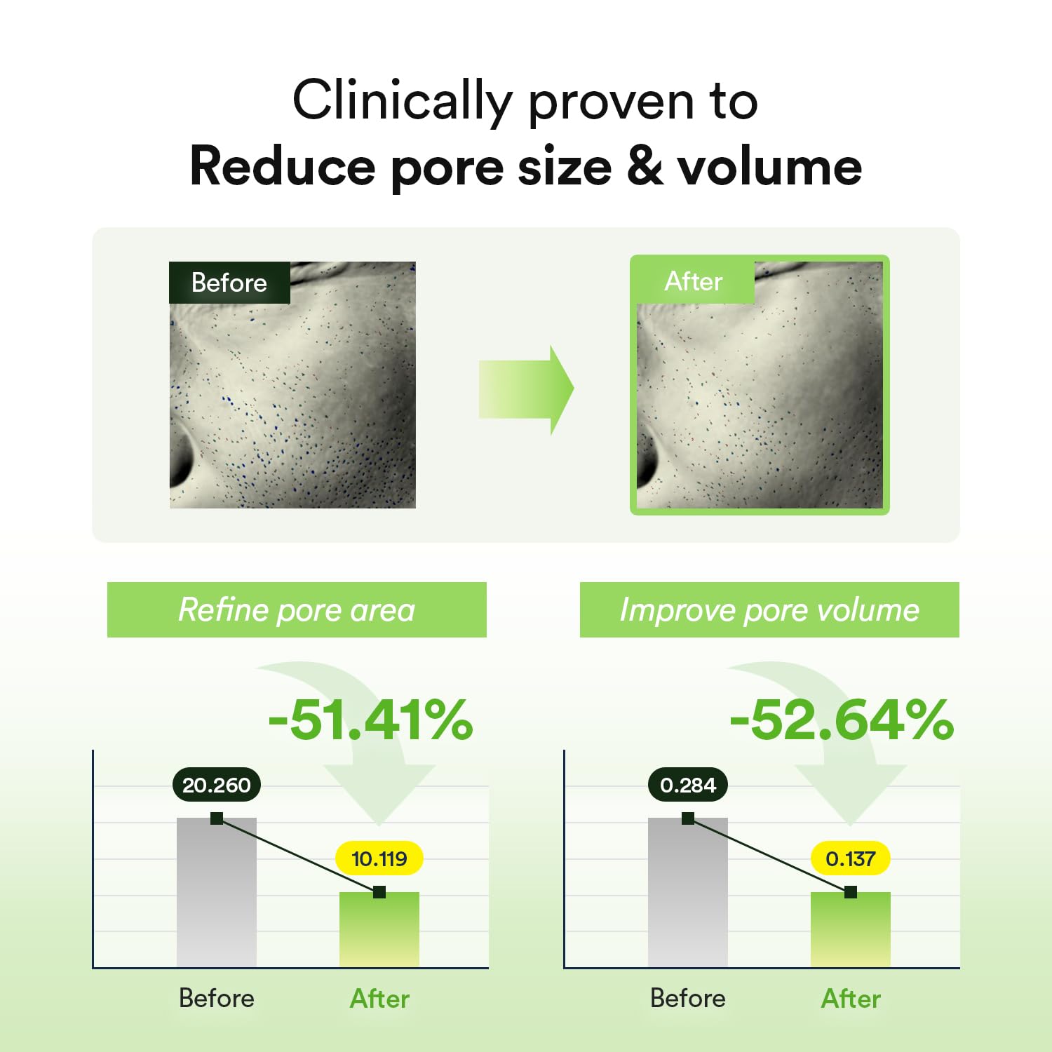 Abib 12-Day Radiance Renewal SET: Collagen Gel Mask 12 Sheets (Sedum & Jericho Rose & Heartleaf) I Korean Skincare, Vegan, Cooling, Calming, Nourishing, Hydrogel Face Mask - Image 8