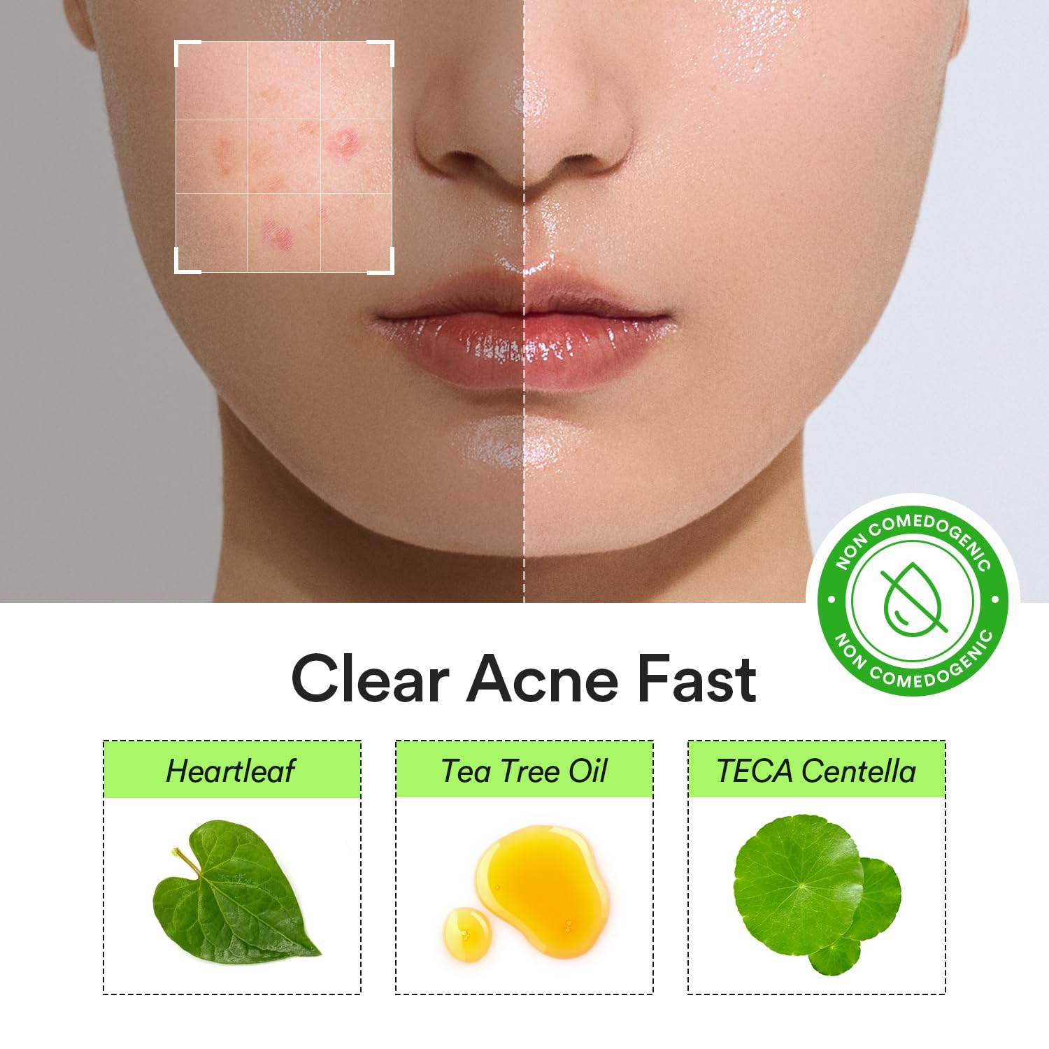 Abib Heartleaf Calming Spot Patch 2 Sizes 78 Patches, Waterproof Pimple Patches for Face, Invisible, Ultra-Adherent & Fast-Soothing Zit Care (10mm*48pcs / 12mm*30pcs) - Image 3