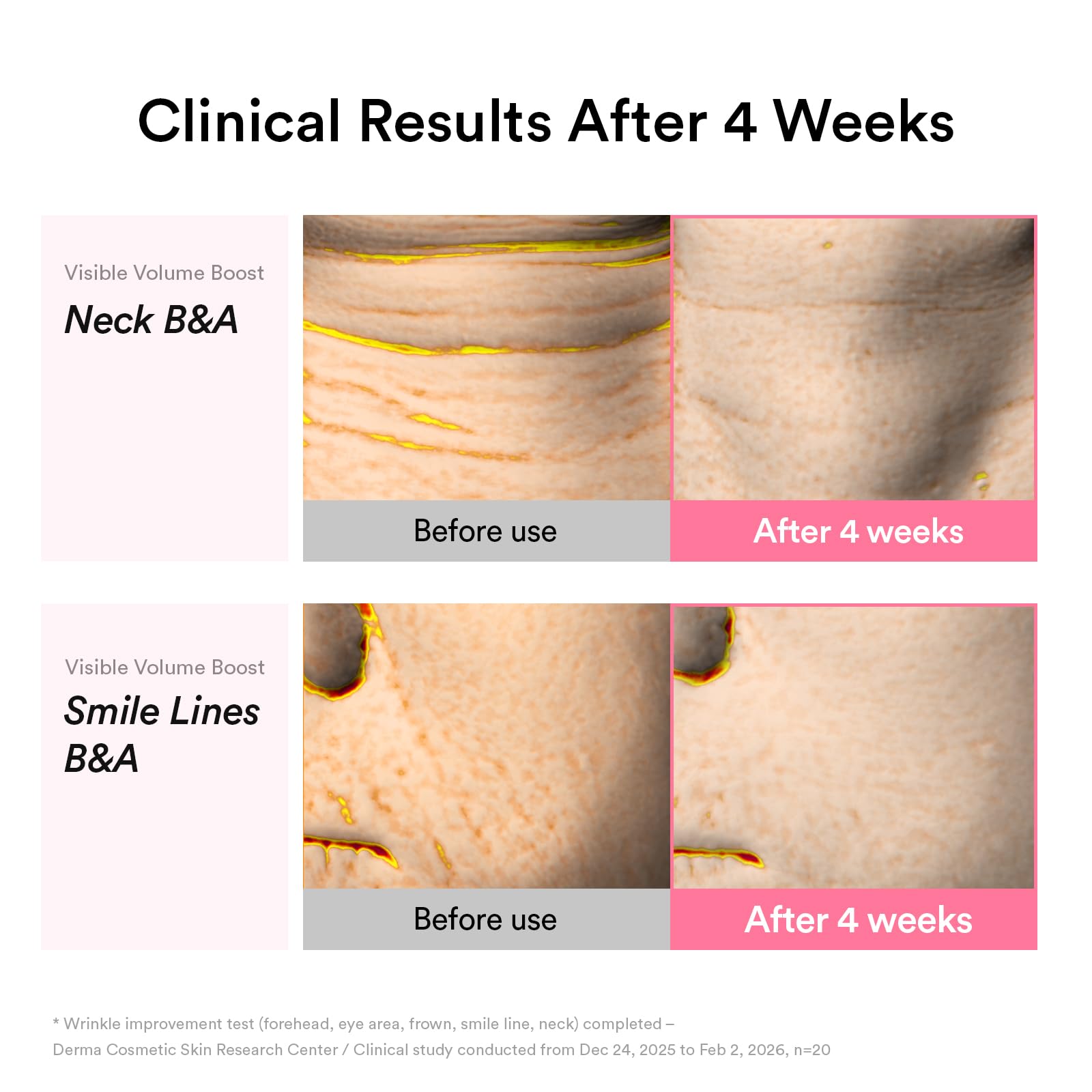 Abib PDRN Retinal Firming Duo: PDRN Retinal Eye Patches with Glow Jelly, 60 Count & PDRN Volume Fill-It Booster Cream1.01 fl oz | Eye Patches and Peptide Retinal Cream for Forehead, Smile Lines, Neck - Image 9