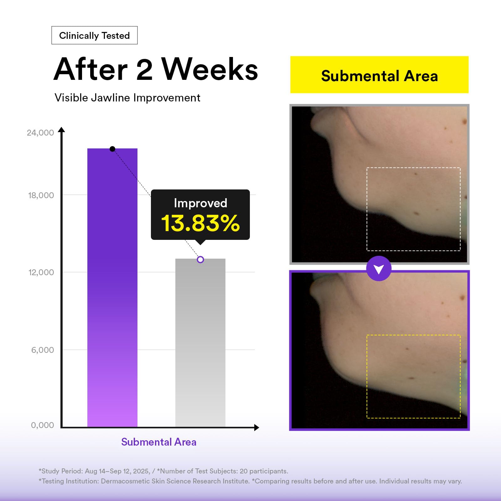 Abib Silhouette Lifting Cream Mask V-up Solution (4 sheets) with PLGA-Peptide, Jawline Double Chin Firming, Liftting Mask, Elasticity Care, Face Lift Mask, Skin Tightening, Chin Lift, Korean Skincare - Image 6