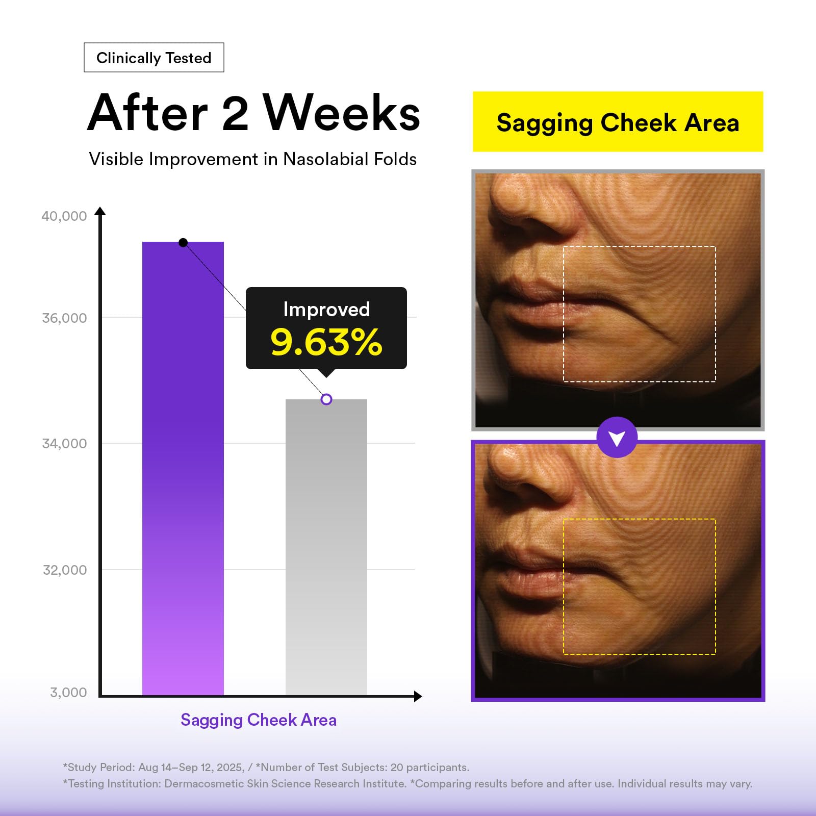 Abib Silhouette Lifting Cream Mask V-up Solution (4 sheets) with PLGA-Peptide, Jawline Double Chin Firming, Liftting Mask, Elasticity Care, Face Lift Mask, Skin Tightening, Chin Lift, Korean Skincare - Image 7